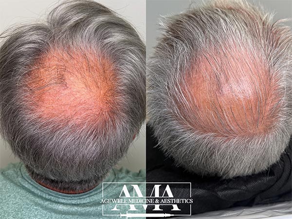 Hair Treatment Specialist Serving Bridgewater, Bedminster, NJ Hair Treatment Specialist Serving Bridgewater, Bedminster, NJ