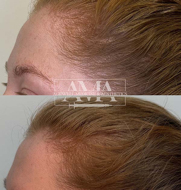 Hair Treatment Specialist Serving Bridgewater, Bedminster, NJ Hair Treatment Specialist Serving Bridgewater, Bedminster, NJ