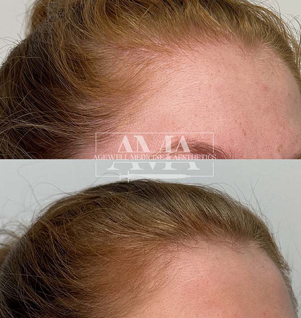 Hair Treatment Specialist Serving Bridgewater, Bedminster, NJ Hair Treatment Specialist Serving Bridgewater, Bedminster, NJ