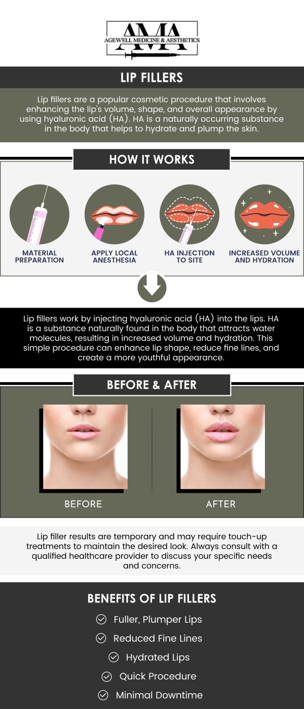 Lip Filler Specialist Serving Bridgewater, Bedminster, NJ