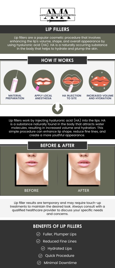 Lip Filler Specialist Serving Bridgewater, Bedminster, NJ
